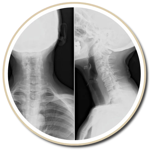 5 Components of The Gonstead Technique - Chiropractor South